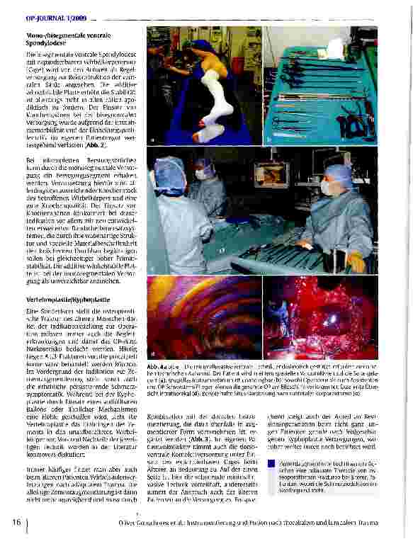 Vorschauseite 5: Instrumentierung und Fusion nach thorakalem und lumbalem Trauma