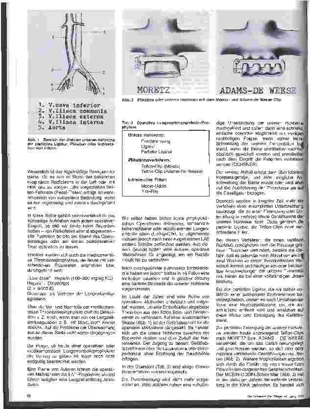 Vorschauseite 2: Operative Lungenembolieprophylaxe