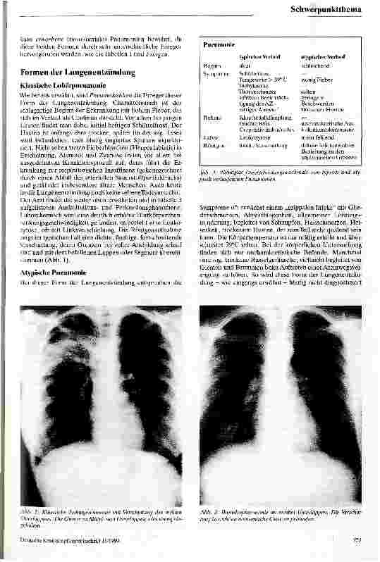 Vorschauseite 2: Pneumonien Diagnostik und grundsätzliche Behandlungsmöglichkeiten