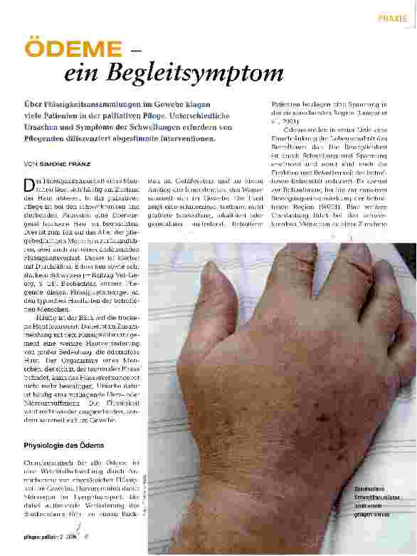 Vorschauseite 1: ÖDEME - ein Begleitsymptom