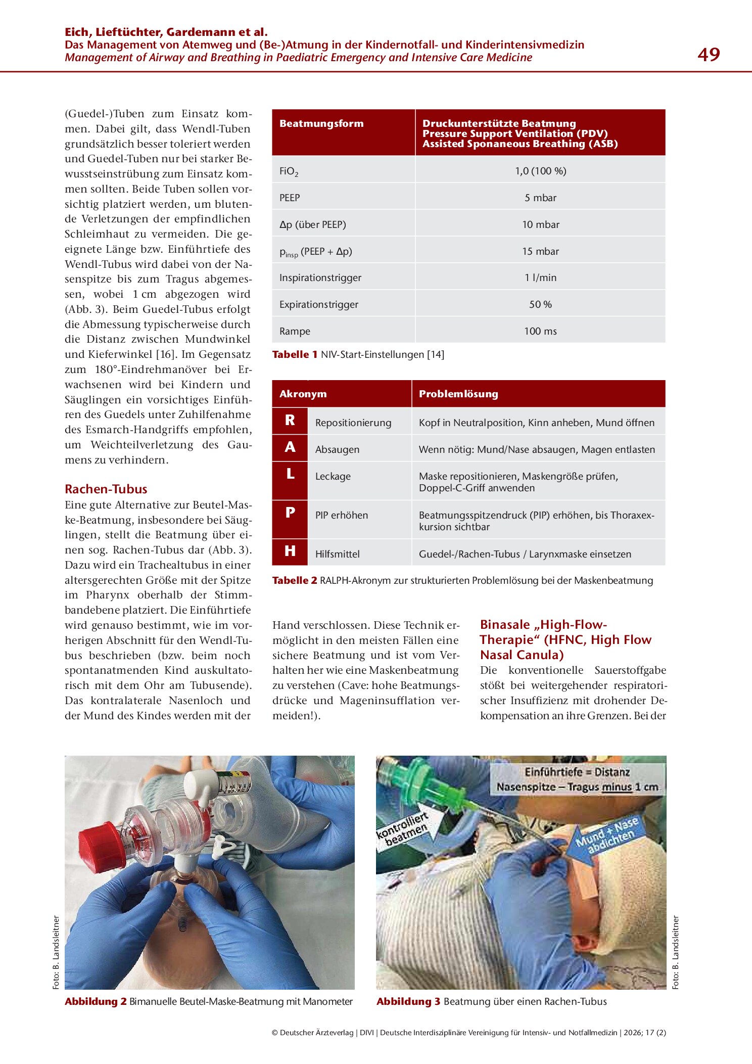 Vorschauseite 4: Das Management von Atemweg und (Be-)Atmung in der Kindernotfall- und Kinderintensivmedizin