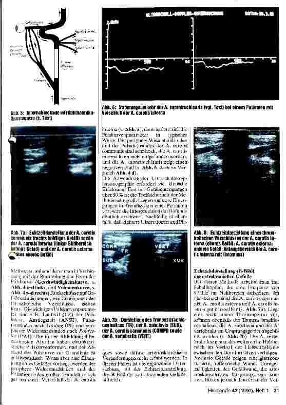 Vorschauseite 3: Zerebrale Durchblutungsstörungen - Ursachen, Klinik, noninvasive Diagnostik