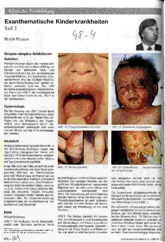 Vorschauseite 1: Exanthematische Kinderkrankheiten
