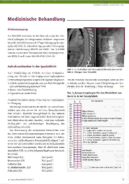 Vorschauseite 5: Querschnittlähmung