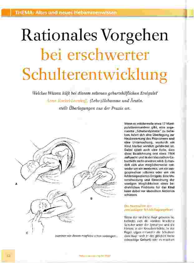Vorschauseite 1: Rationales Vorgehen bei erschwerter Schulterentwicklung