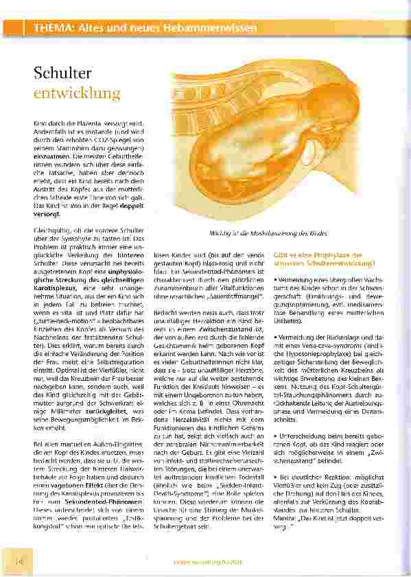 Vorschauseite 3: Rationales Vorgehen bei erschwerter Schulterentwicklung