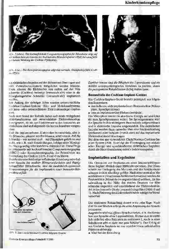 Vorschauseite 3: Die Taubheit Möglichkeiten der prothetischen Versorgung auch im Kindesalter