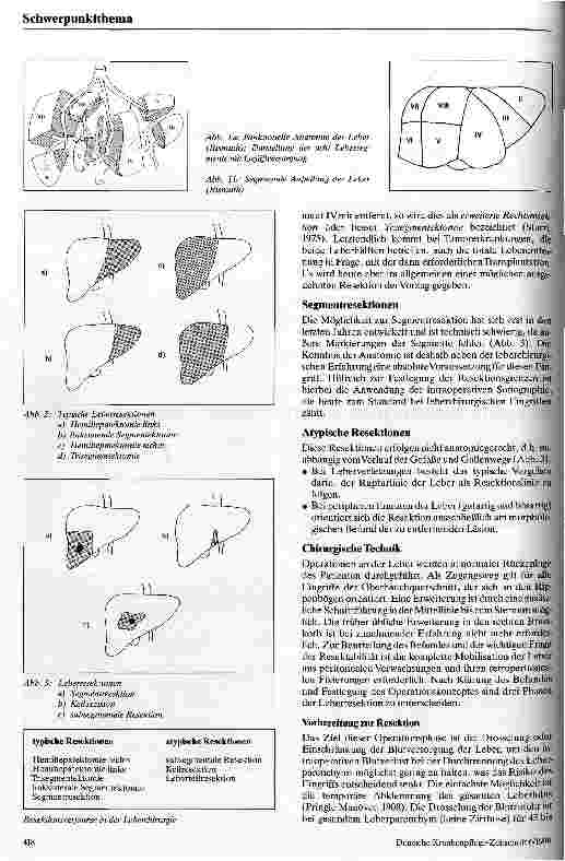 Vorschauseite 2: Möglichkeiten und Grenzen der Leberchirurgie