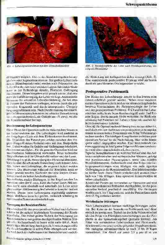 Vorschauseite 3: Möglichkeiten und Grenzen der Leberchirurgie