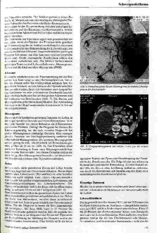 Vorschauseite 5: Möglichkeiten und Grenzen der Leberchirurgie