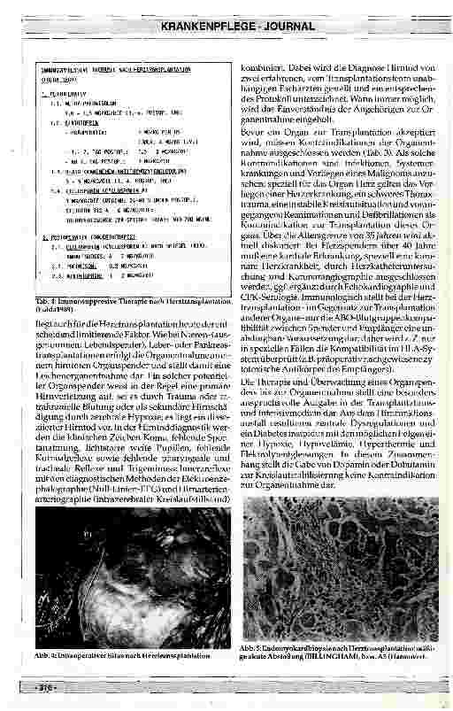 Vorschauseite 4: Herztransplantation: Indikation, Technik und Ergebnisse