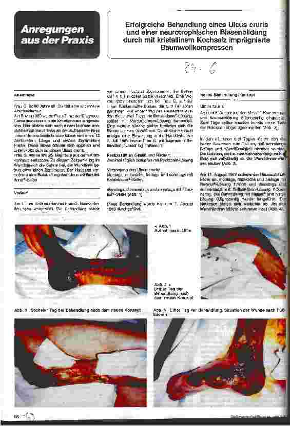 Vorschauseite 1: Erfolgreiche Behandlung eines Ulcus cruris und einer neurotrophischen Blasenbildung mit Baumwollkompressen