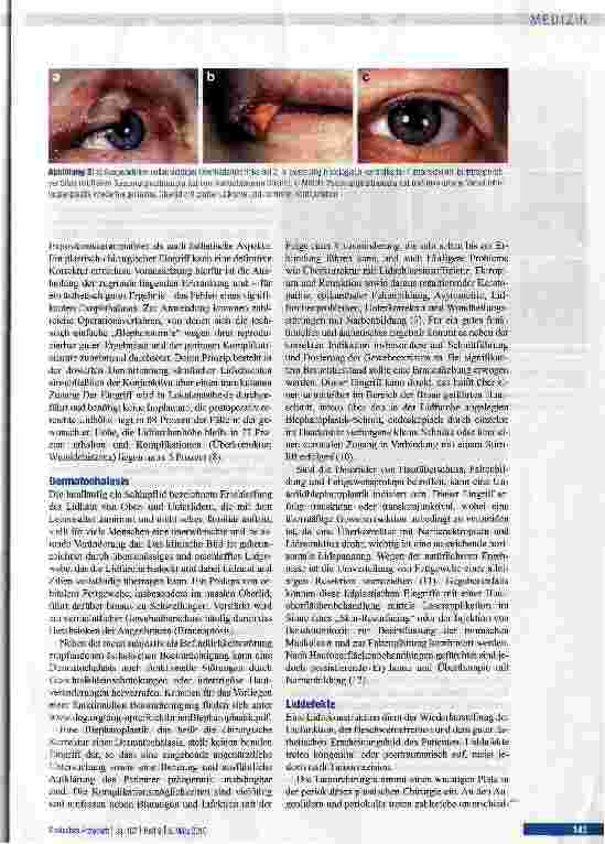 Vorschauseite 3: Periokuläre plastische Chirurgie