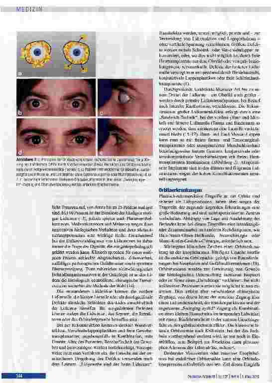 Vorschauseite 4: Periokuläre plastische Chirurgie