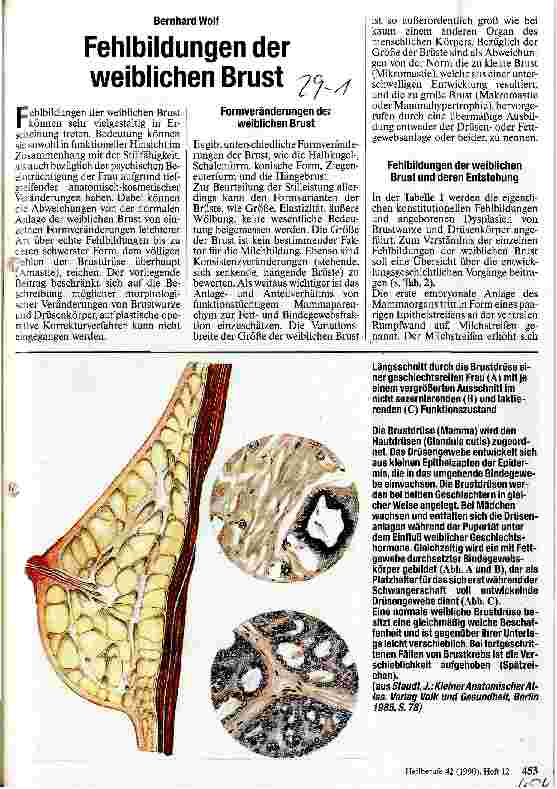 Vorschauseite 1: Fehlbildungen der weiblichen Brust