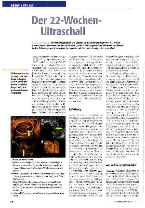 Vorschauseite 1: Der 22-Wochen-Ultraschall
