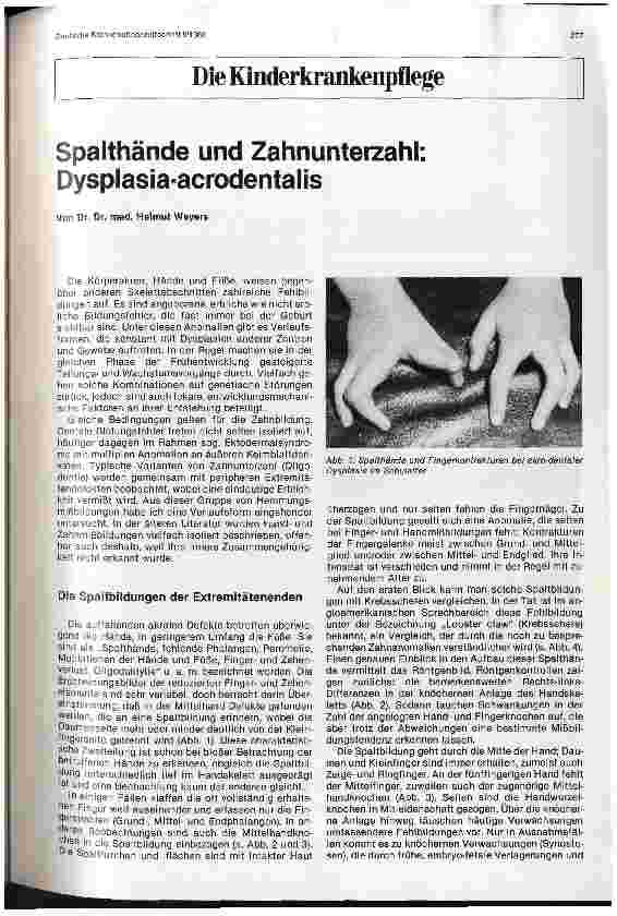 Vorschauseite 1: Spalthände und Zahnunterzahl: Dysplasia-acrodentalis