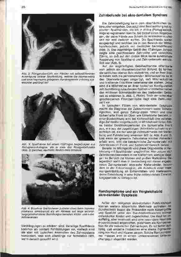 Vorschauseite 2: Spalthände und Zahnunterzahl: Dysplasia-acrodentalis