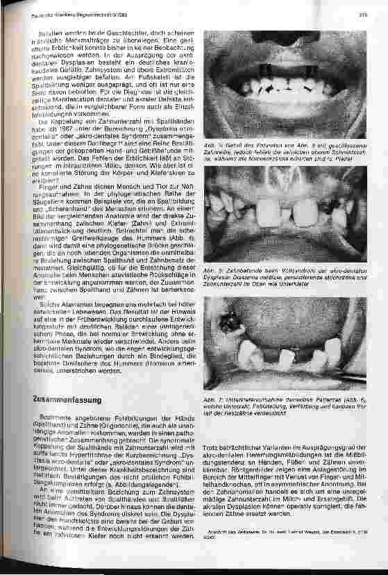 Vorschauseite 3: Spalthände und Zahnunterzahl: Dysplasia-acrodentalis