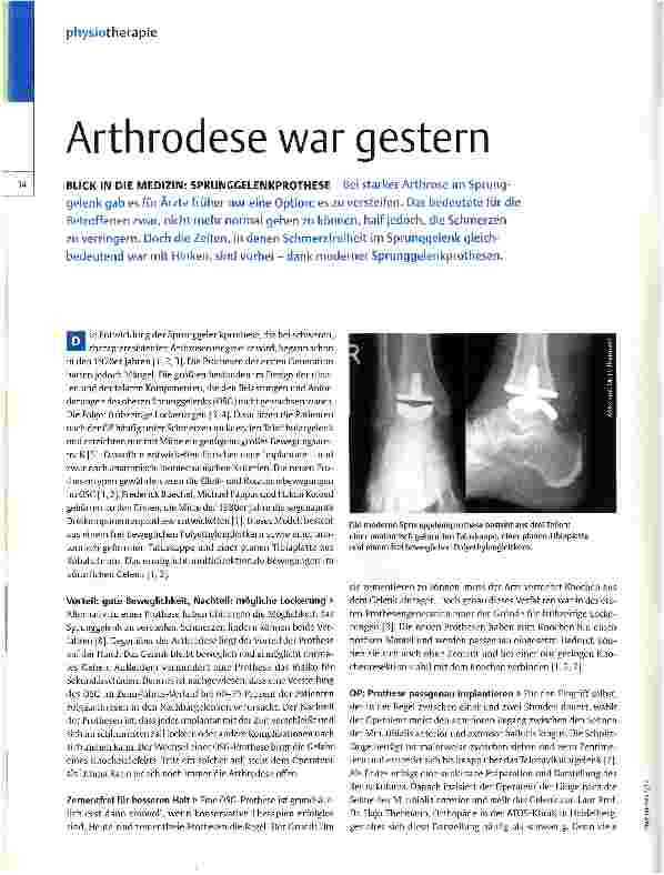Vorschauseite 1: Arthrodese war gestern