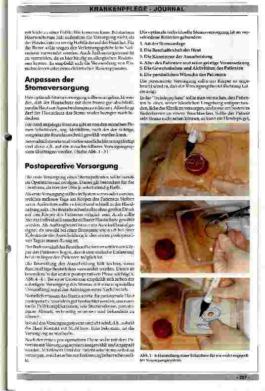 Vorschauseite 2: Allgemeine Stoma-Pflege