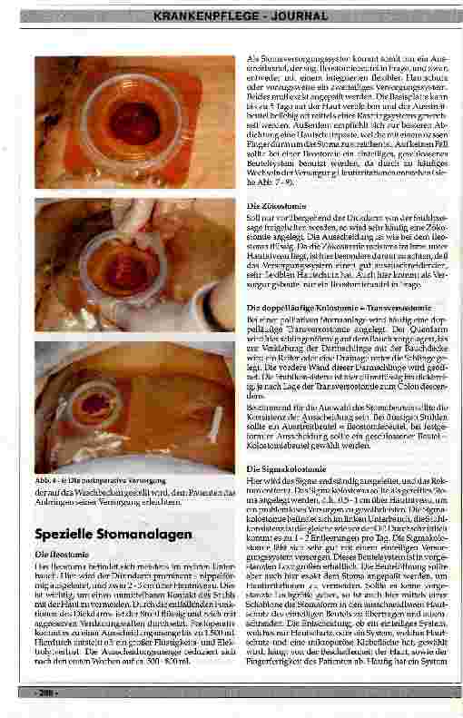 Vorschauseite 3: Allgemeine Stoma-Pflege