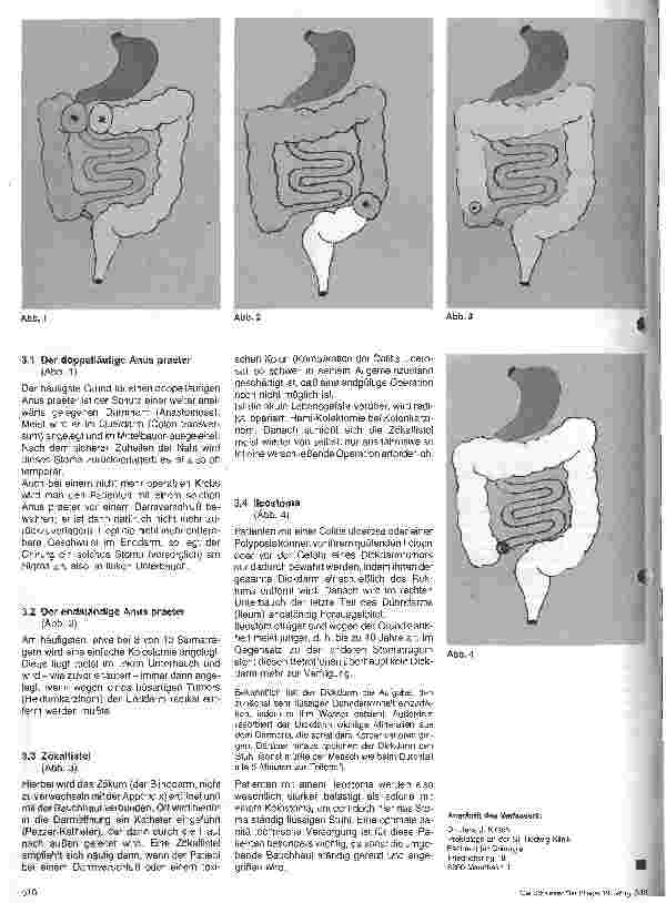 Vorschauseite 2: Stoma-Träger - Grundlagen