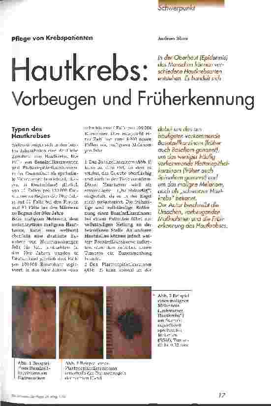 Vorschauseite 1: Hautkrebs: Vorbeugen und Früherkennung