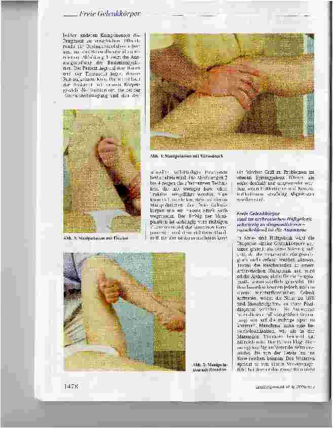 Vorschauseite 3: Der freie Gelenkkörper im arthrotischen Gelenk