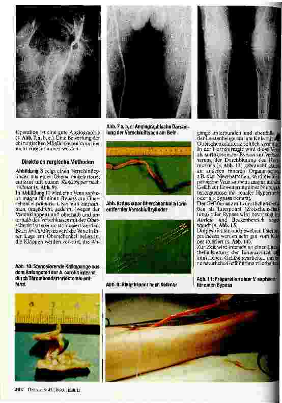 Vorschauseite 2: Möglichkeiten der modernen Gefäßchirurgie