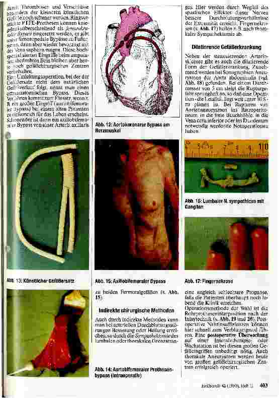 Vorschauseite 3: Möglichkeiten der modernen Gefäßchirurgie