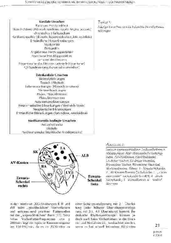 Vorschauseite 2: Supraventrikuläre und ventrikuläre Rhythmusstörungen in der Intensivmedizin