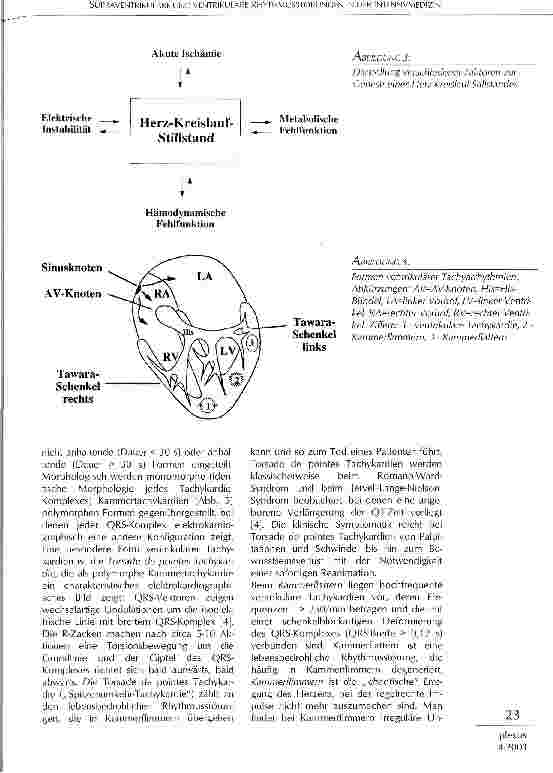 Vorschauseite 4: Supraventrikuläre und ventrikuläre Rhythmusstörungen in der Intensivmedizin