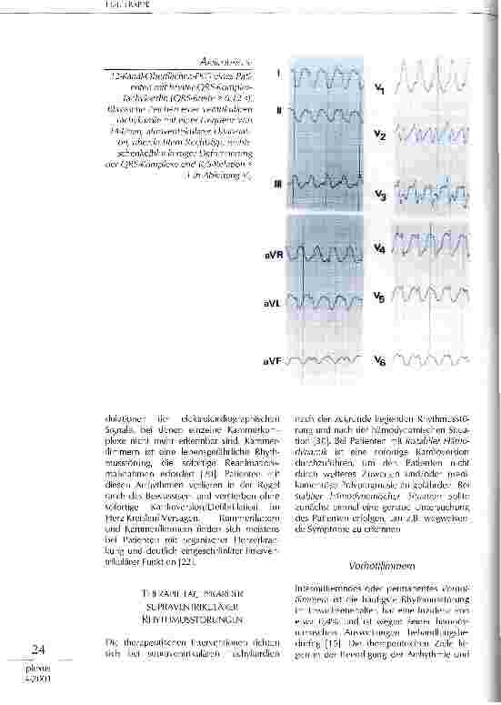 Vorschauseite 5: Supraventrikuläre und ventrikuläre Rhythmusstörungen in der Intensivmedizin