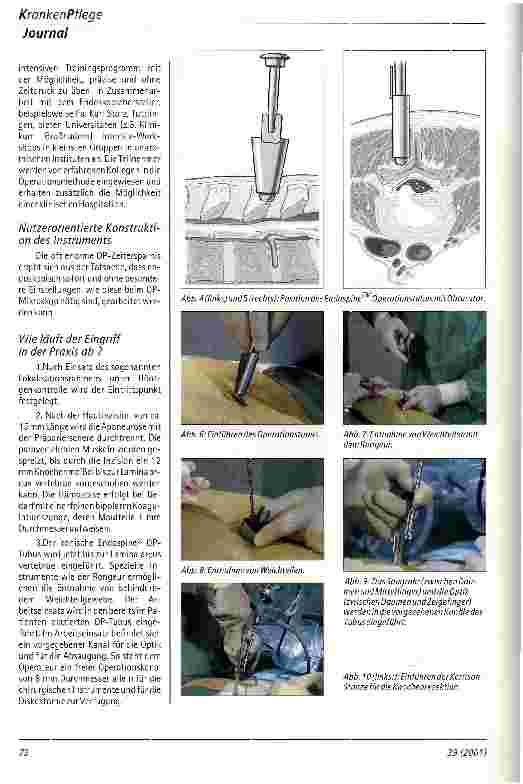 Vorschauseite 3: Endoskopische minimalinvasive Therapie des lumbalen Bandscheibenvorfalls