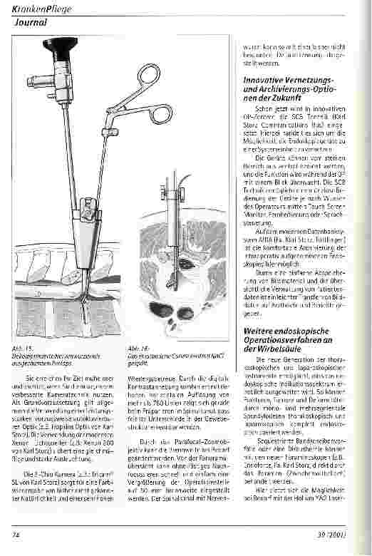 Vorschauseite 5: Endoskopische minimalinvasive Therapie des lumbalen Bandscheibenvorfalls
