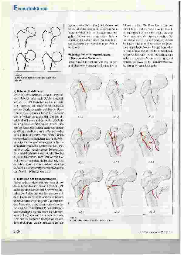 Vorschauseite 3: Operative Behandlung proximaler Femurfrakturen
