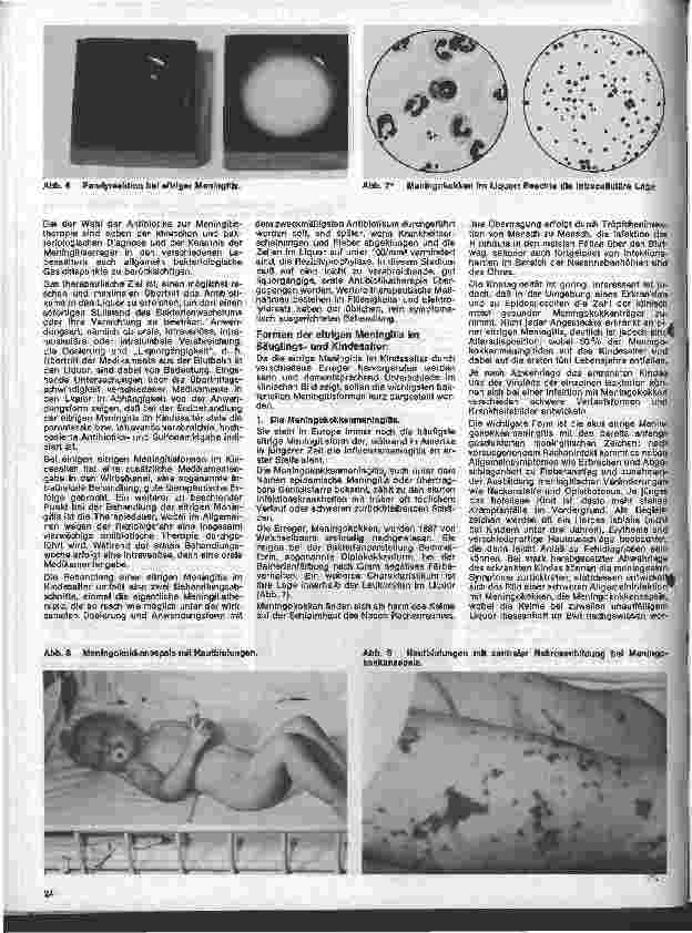 Vorschauseite 3: Kinderheilkunde 22. Folge: Die eitrige Meningitis