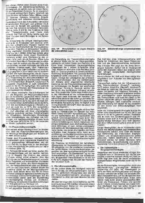 Vorschauseite 4: Kinderheilkunde 22. Folge: Die eitrige Meningitis