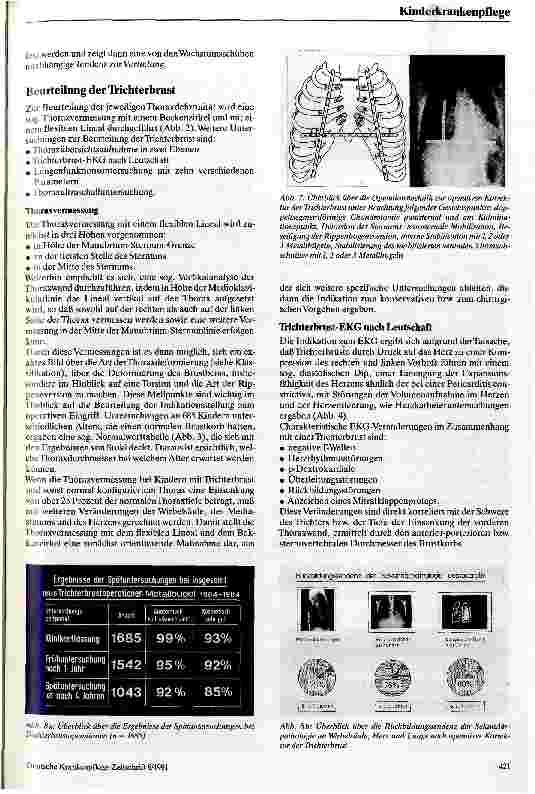 Vorschauseite 4: Indikation zur Behandlung der Trichterbrust