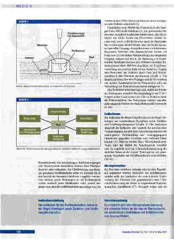 Vorschauseite 2: Portsysteme als integraler Bestandteil von Chemotherapien