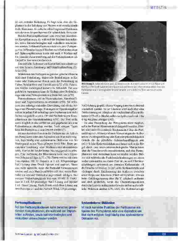 Vorschauseite 5: Portsysteme als integraler Bestandteil von Chemotherapien
