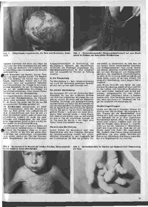 Vorschauseite 2: Kinderchirurgie 1. Folge: Allgemeine kinderchirurgischen Begriffe und Krankheiten