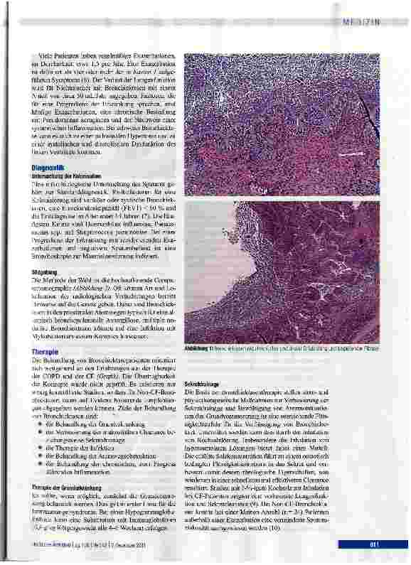 Vorschauseite 3: Bronchiektasen - Diagnostik und Therapie