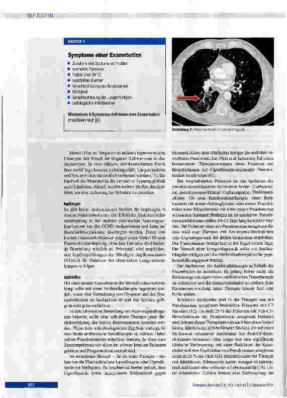 Vorschauseite 4: Bronchiektasen - Diagnostik und Therapie