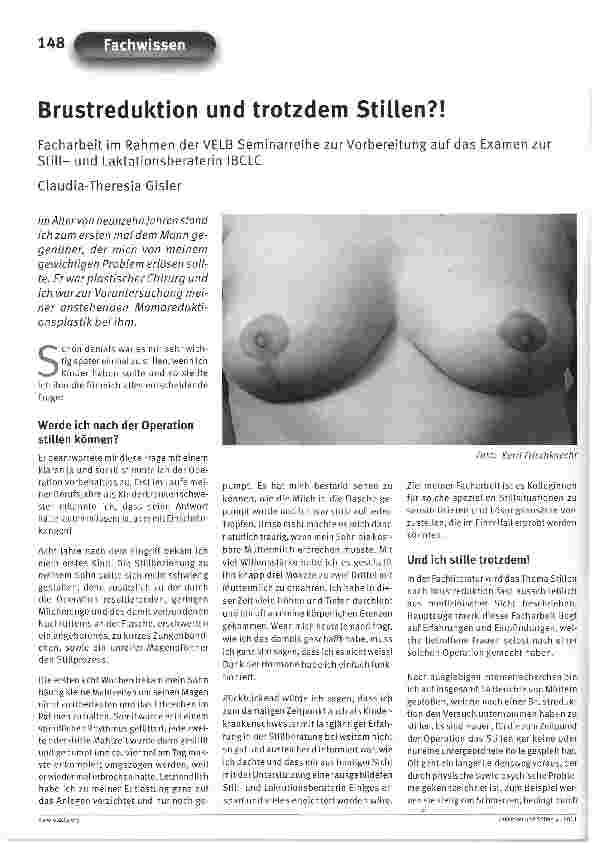 Vorschauseite 1: Brustreduktion und trotzdem Stillen?!