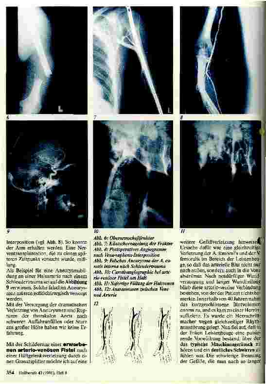 Vorschauseite 3: Möglichkeiten der modernen Gefäßchirurgie