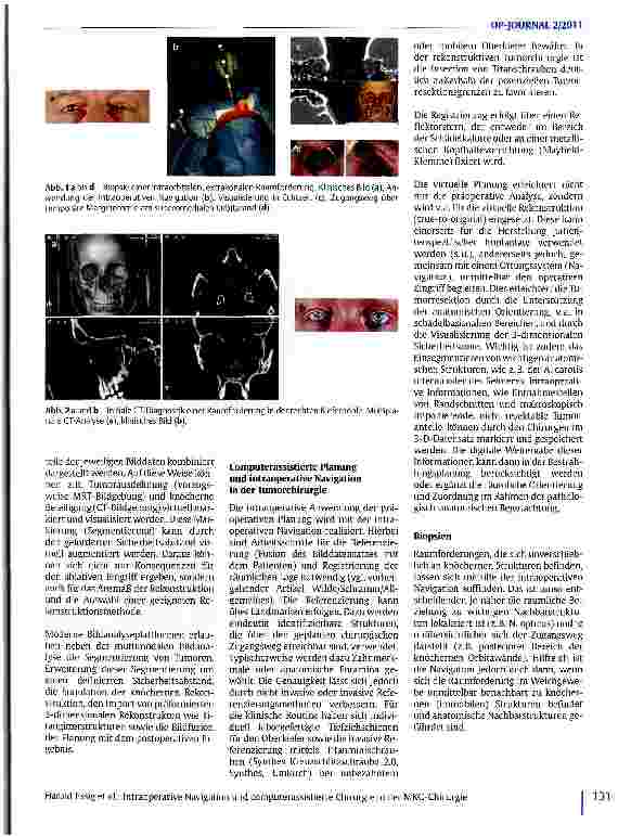 Vorschauseite 2: Intraoperative Navigation und computerassistierte Chirurgie in der MKG-Chirurgie