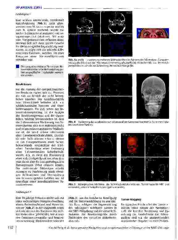 Vorschauseite 3: Intraoperative Navigation und computerassistierte Chirurgie in der MKG-Chirurgie
