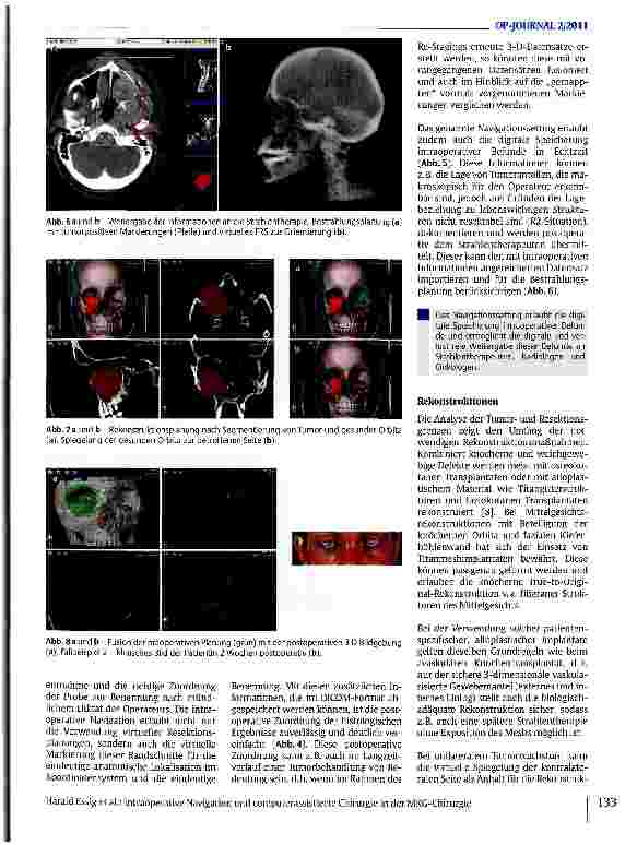 Vorschauseite 4: Intraoperative Navigation und computerassistierte Chirurgie in der MKG-Chirurgie